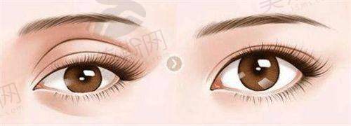 遵义汇川广慈整形医院2025年价格表