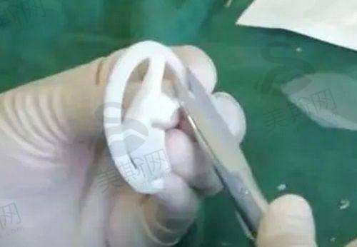 整形的意义与选择