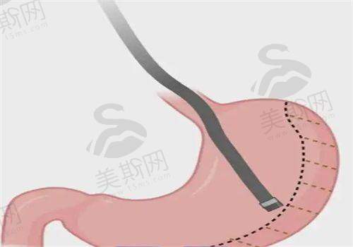 与其他医院对比优势