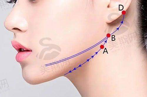 黄海医生技术水平高
