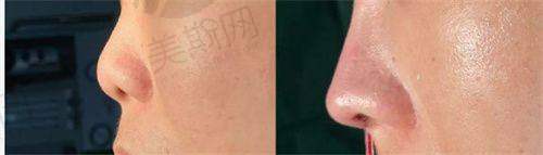 伊馥丽诊所项目及价格