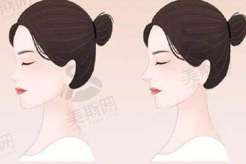 荆门玫漫医疗美容门诊部面部肉毒素注射709元，痤疮800元起，祛斑隆鼻价格也合理