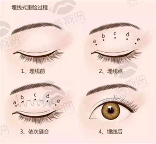 数字化美眼