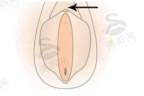 晋城韩尚医美整形门诊部玻尿酸丰耳垂2739元起、开内眼角1313元起等项目价格公布