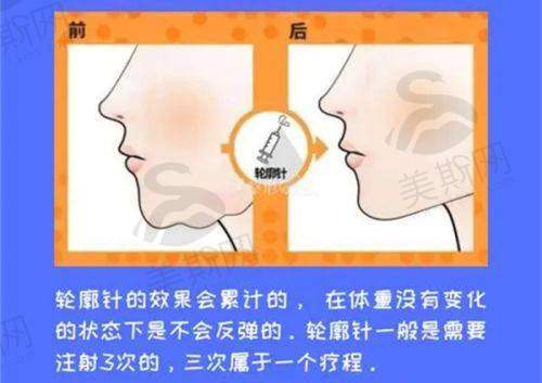 选择门诊部的考量