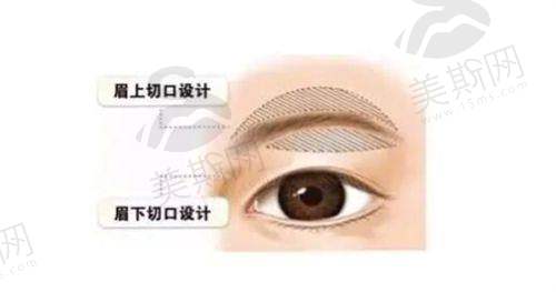 晋城矿务局医院整形美容科杯状耳、双眼皮、下颌等多项整形价格情况参考