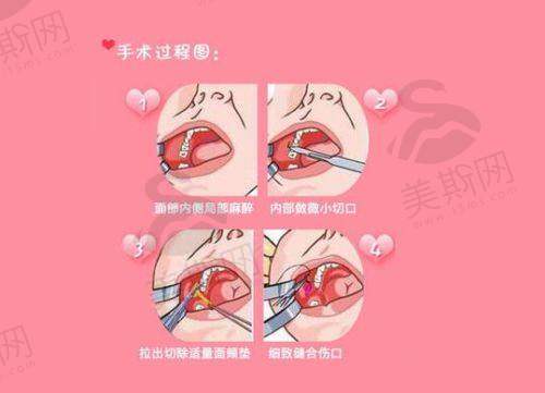 价格方面的综合优势