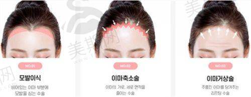 选择晋城矿务局医院整形美容科的优势