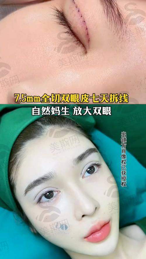 赵成利医生坐诊医院信息