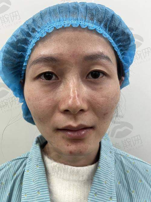 时辉医生技术水平高
