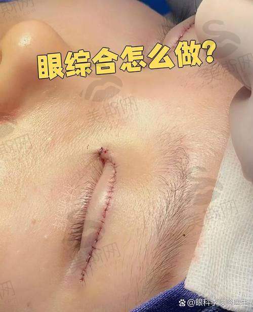 高奢定制美鼻
