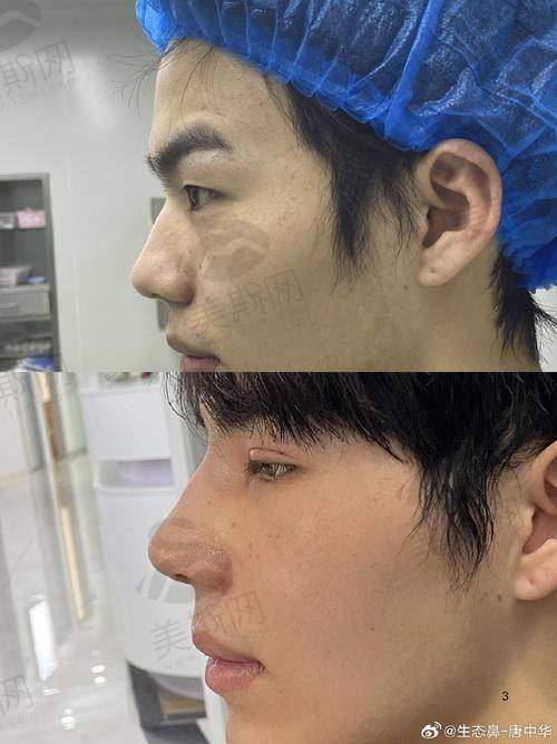 田芳斌医生技术水平高