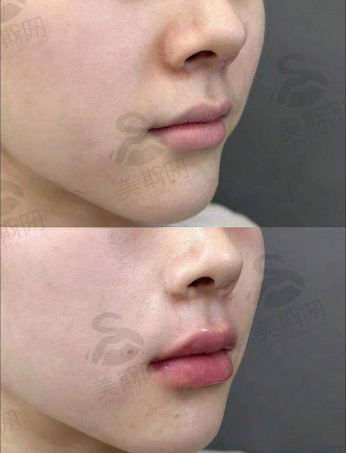 王冠医生技术水平高:五大核心技术优势解析