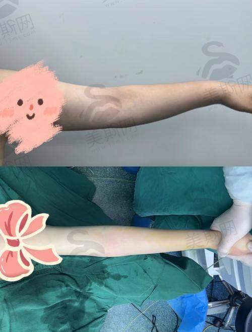 乌鲁木齐各整形医院收费标准分析