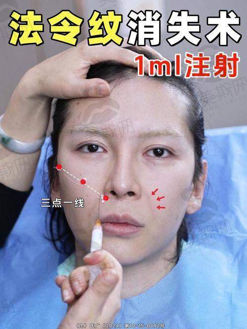 天使针天玑活性骨胶原支架技术优势在哪