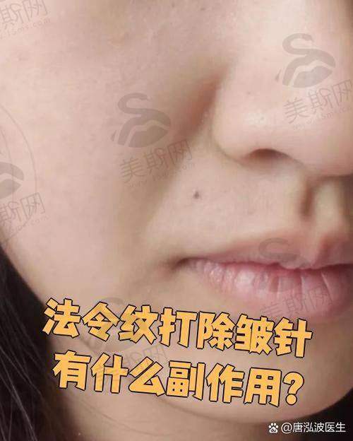 天使针天玑收费标准受哪些因素影响