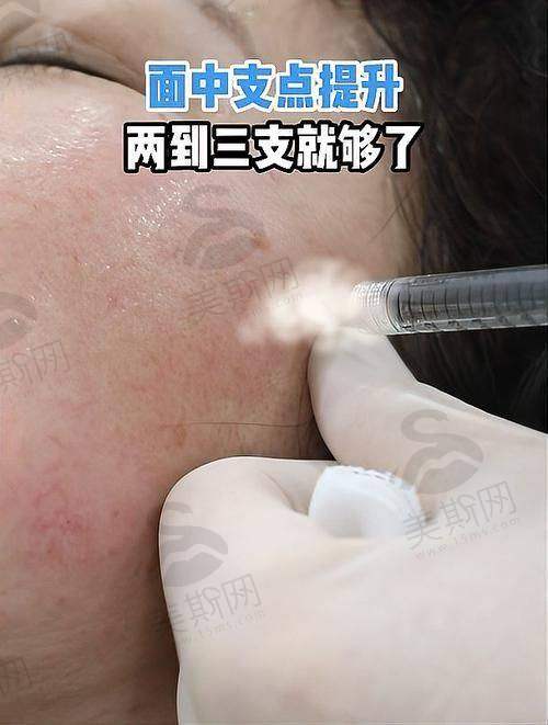 使用天使针天玑的医生优势有哪些