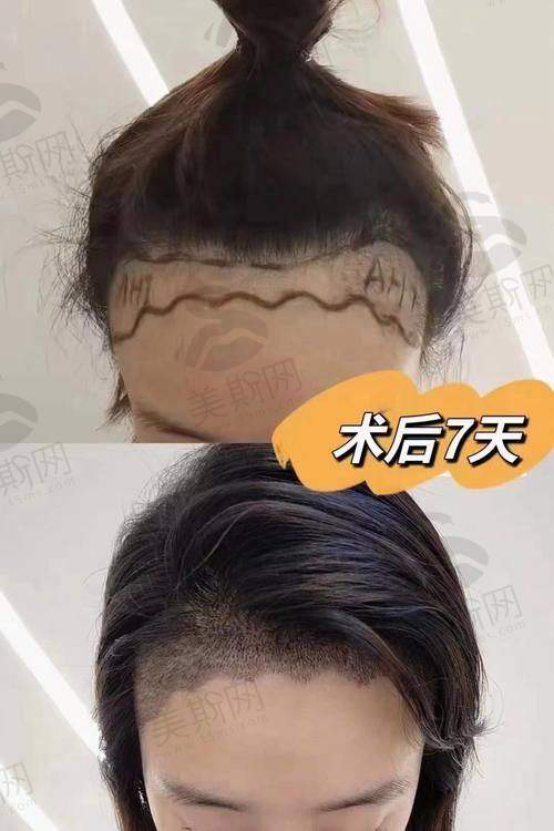 刘斌医生口碑评价及反馈内容