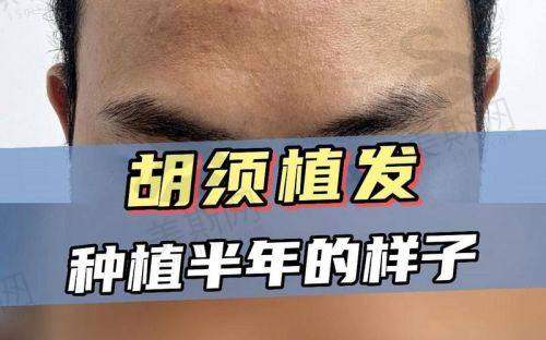 樊哲祥医生坐诊哪个医院?