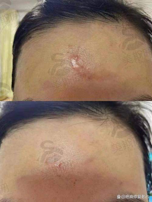 关灿彬医生技术水平高