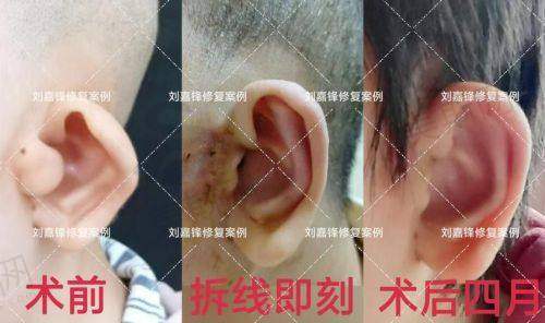 田艳医生擅长项目