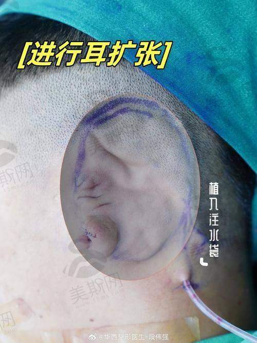 王永振医生技术水平高