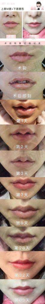 田艳医生技术水平高