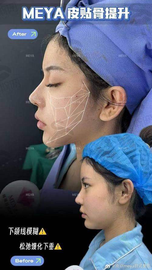 黄海医生擅长项目