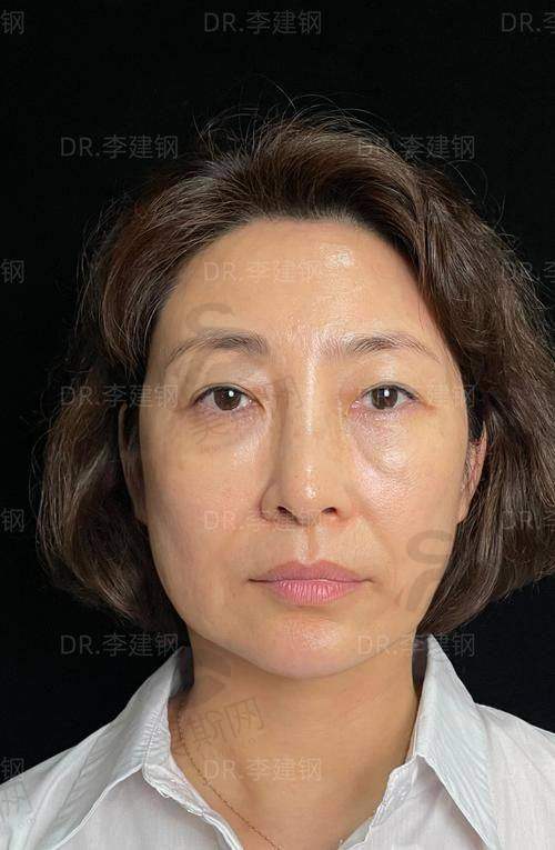 蒙石南院长预约挂号