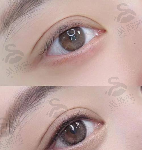 热门整形项目介绍