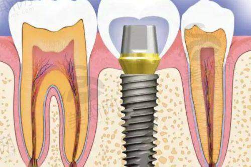 避开这些预约误区,挂号效率提升50%