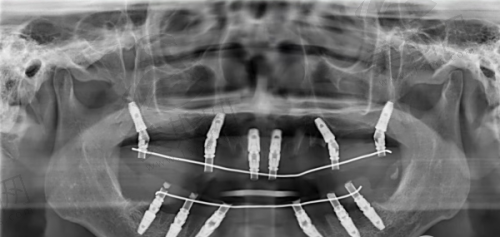 天津市口腔医院公众号预约步骤详解