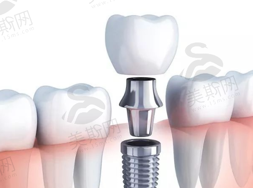 天津市口腔医院预约电话是多少?