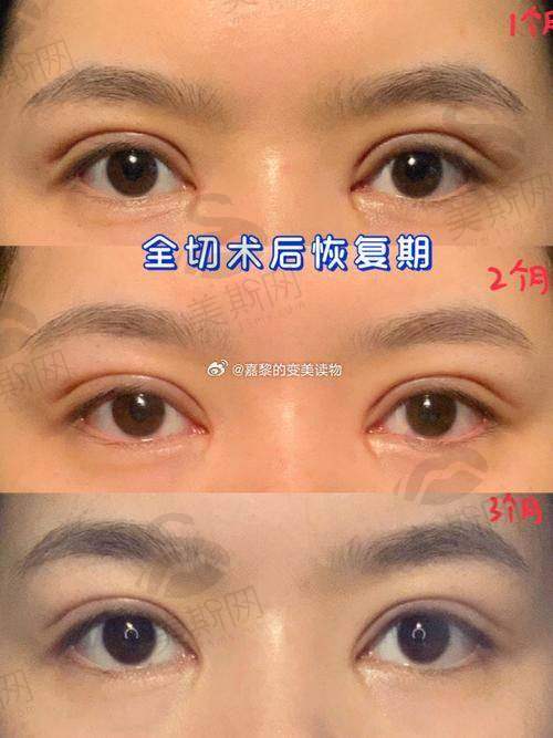 深圳美莱医院的医生优势