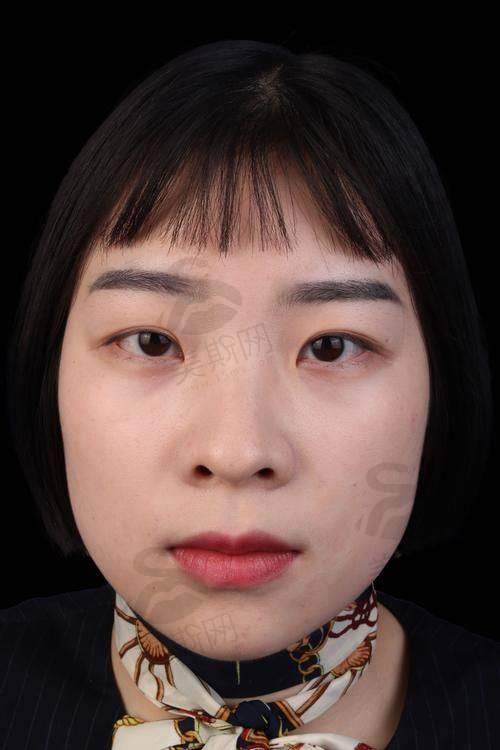 上海丽质医院的口碑实例