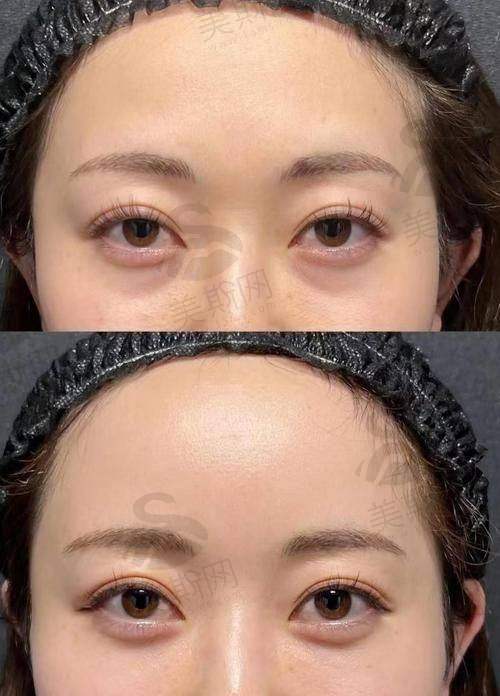 深圳美莱和富华医院的口碑实例