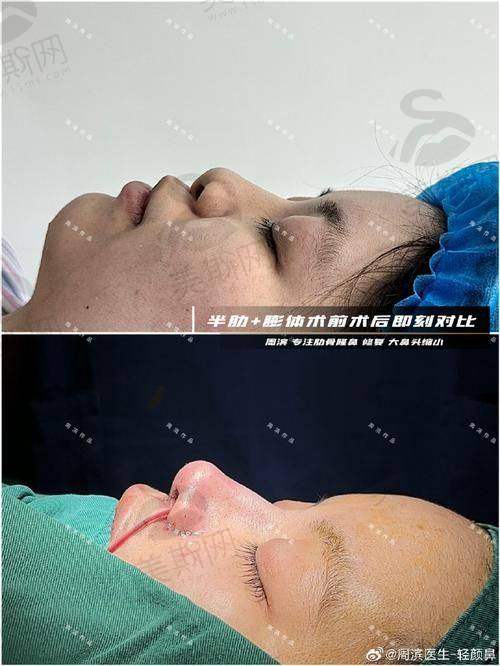 梅够明医生价格表（2025年全新）