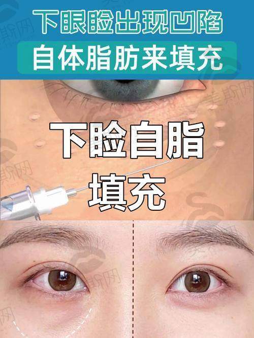 深圳美莱和富华医院的收费标准