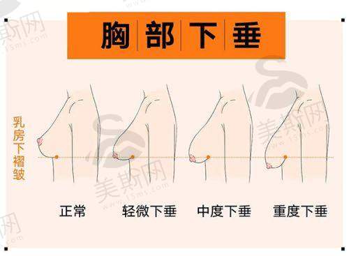 南京鼓楼新秀医疗美容门诊部激光缓解、私密整形等项目价格亲民,体验划算!