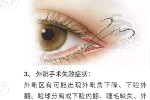 北京臻瑞汇美医疗美容门诊部注射隆鼻、水光针、双眼皮、点痣、胸整价格全知道