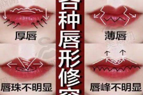 植发手术相关科普