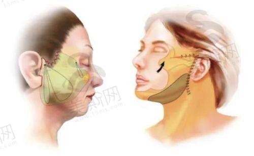 环境与设施保护