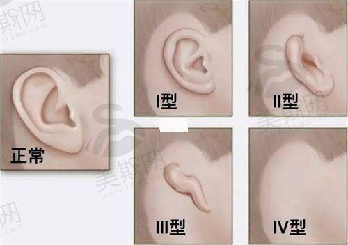 吸脂与脂肪填充项目