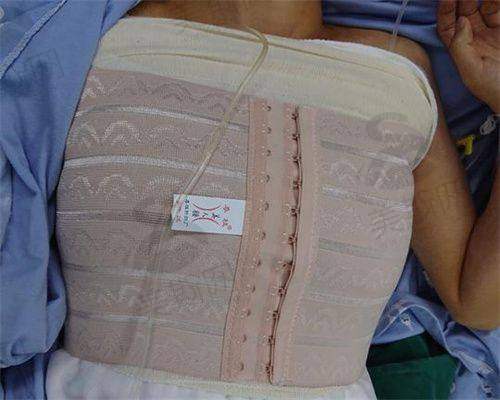 合肥新生医疗美容医院激光祛斑3600元起，植发最低4326元，解决多种医美难题