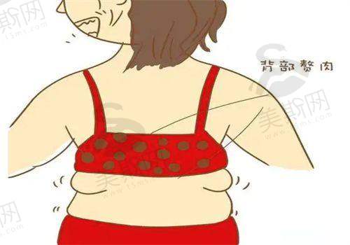 其他可能涉及的整形项目及价格参考