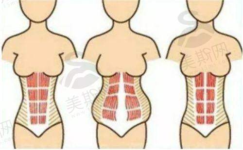 医美项目价格优势