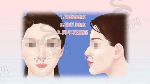 南京爱学菲庭医疗美容诊所2025年价格表