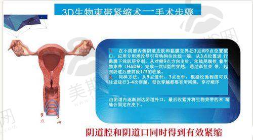 鼻综合修复项目