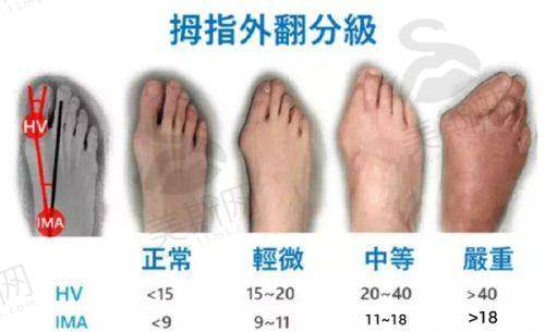 理性提醒