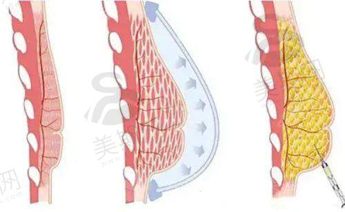 植发手术前后注意事项